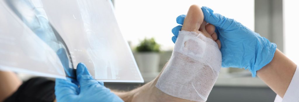 ASTM D6319 for nitrile examination gloves